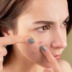 What are Papules? Early signs and Risks